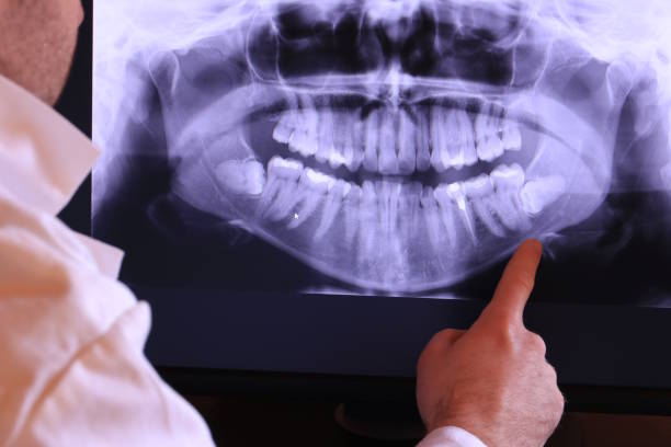Best Chipped Tooth Repair Near Me  in Cypress Gardens, FL